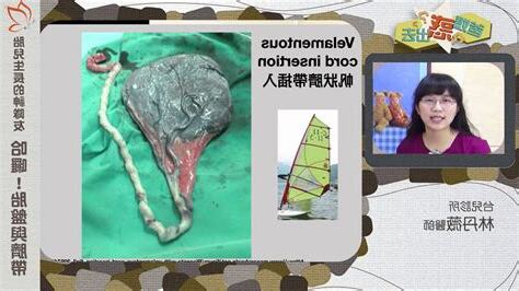 臍帶 胎盤